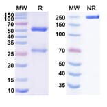 SDS-PAGE - Alomfilimab Biosimilar - Anti-ICOS Antibody - BSA and Azide free (A339065) - Antibodies.com