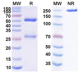 SDS-PAGE - Coprelotamab Biosimilar - Anti-ErbB2 Antibody - BSA and Azide free (A339068) - Antibodies.com
