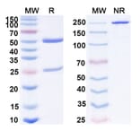 SDS-PAGE - Penpulimab Biosimilar - Anti-PD 1 Antibody - BSA and Azide free (A339076) - Antibodies.com