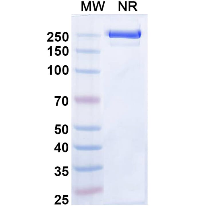 SDS-PAGE - Zeluvalimab Biosimilar - Anti-PD 1 Antibody - BSA and Azide free (A339078) - Antibodies.com