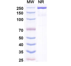 SDS-PAGE - Zimbirelimab Biosimilar - Anti-PD 1 Antibody - BSA and Azide free (A339080) - Antibodies.com