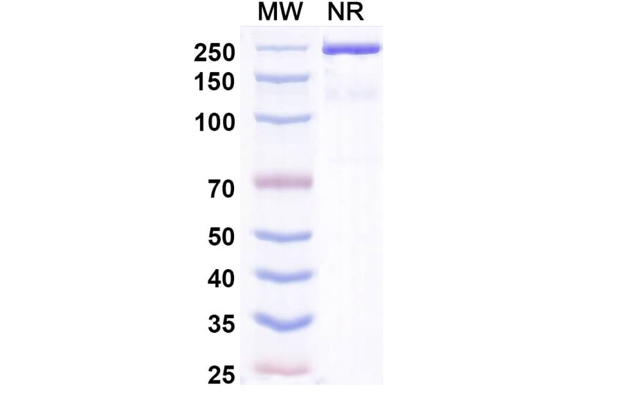 SDS-PAGE - Zimbirelimab Biosimilar - Anti-PD 1 Antibody - BSA and Azide free (A339080) - Antibodies.com
