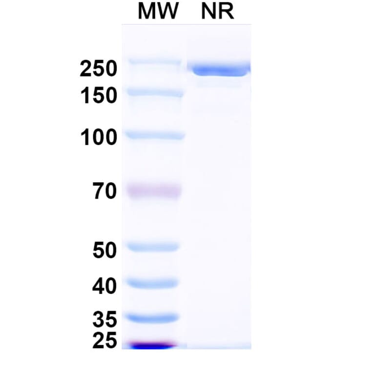 SDS-PAGE - Zimbirelimab Biosimilar - Anti-PD 1 Antibody - BSA and Azide free (A339080) - Antibodies.com