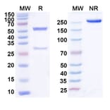 SDS-PAGE - Domvanalimab Biosimilar - Anti-TIGIT Antibody - BSA and Azide free (A339086) - Antibodies.com