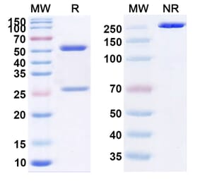 SDS-PAGE - Ebdarokimab Biosimilar - Anti-IL12B Antibody - BSA and Azide free (A339088) - Antibodies.com