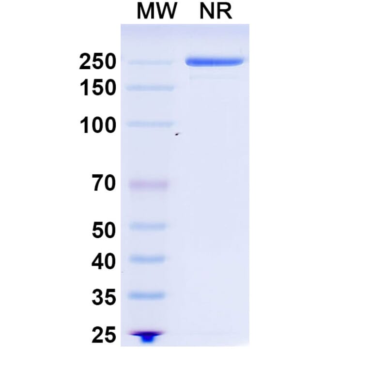 SDS-PAGE - Recaticimab Biosimilar - Anti-PCSK9 Antibody - BSA and Azide free (A339090) - Antibodies.com