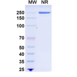SDS-PAGE - Recaticimab Biosimilar - Anti-PCSK9 Antibody - BSA and Azide free (A339090) - Antibodies.com