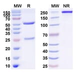 SDS-PAGE - Torudokimab Biosimilar - Anti-IL-33 Antibody - BSA and Azide free (A339091) - Antibodies.com