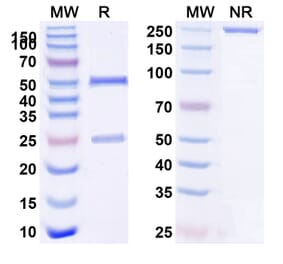 SDS-PAGE - Tozorakimab Biosimilar - Anti-IL-33 Antibody - BSA and Azide free (A339092) - Antibodies.com