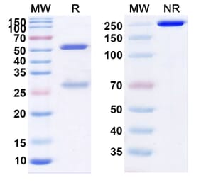 SDS-PAGE - Enibarcimab Biosimilar - Anti-Adrenomedullin Antibody - BSA and Azide free (A339100) - Antibodies.com