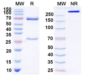 SDS-PAGE - Idactamab Biosimilar - Anti-ASCT2 Antibody - BSA and Azide free (A339102) - Antibodies.com
