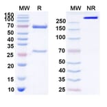 SDS-PAGE - Idactamab Biosimilar - Anti-ASCT2 Antibody - BSA and Azide free (A339102) - Antibodies.com