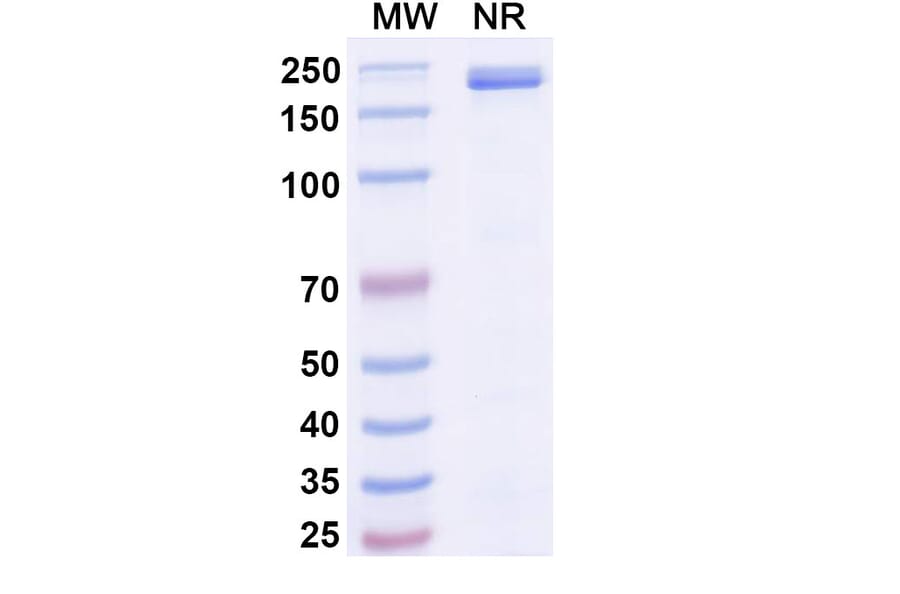 SDS-PAGE - Mibavademab Biosimilar - Anti-Leptin Receptor Antibody - BSA and Azide free (A339110) - Antibodies.com