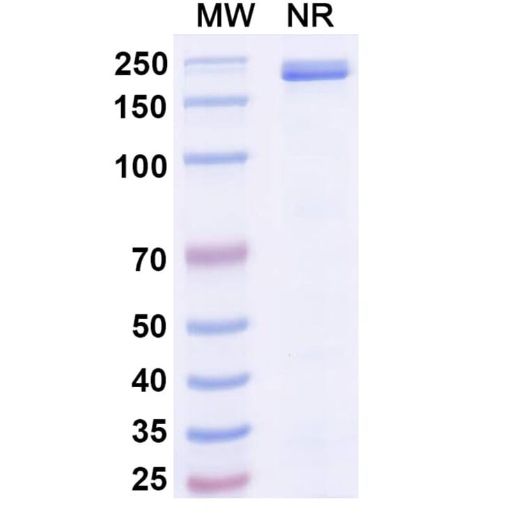 SDS-PAGE - Mibavademab Biosimilar - Anti-Leptin Receptor Antibody - BSA and Azide free (A339110) - Antibodies.com