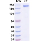 SDS-PAGE - Mibavademab Biosimilar - Anti-Leptin Receptor Antibody - BSA and Azide free (A339110) - Antibodies.com