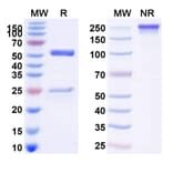 SDS-PAGE - Tixagevimab Biosimilar - Anti-SARS-CoV-2 Spike Protein RBD Antibody - BSA and Azide free (A339120) - Antibodies.com