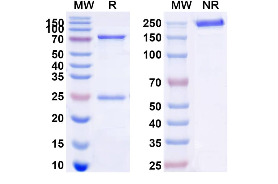 SDS-PAGE - Anti-CD22 Antibody [M971] Biosimilar - BSA and Azide free (A339131) - Antibodies.com