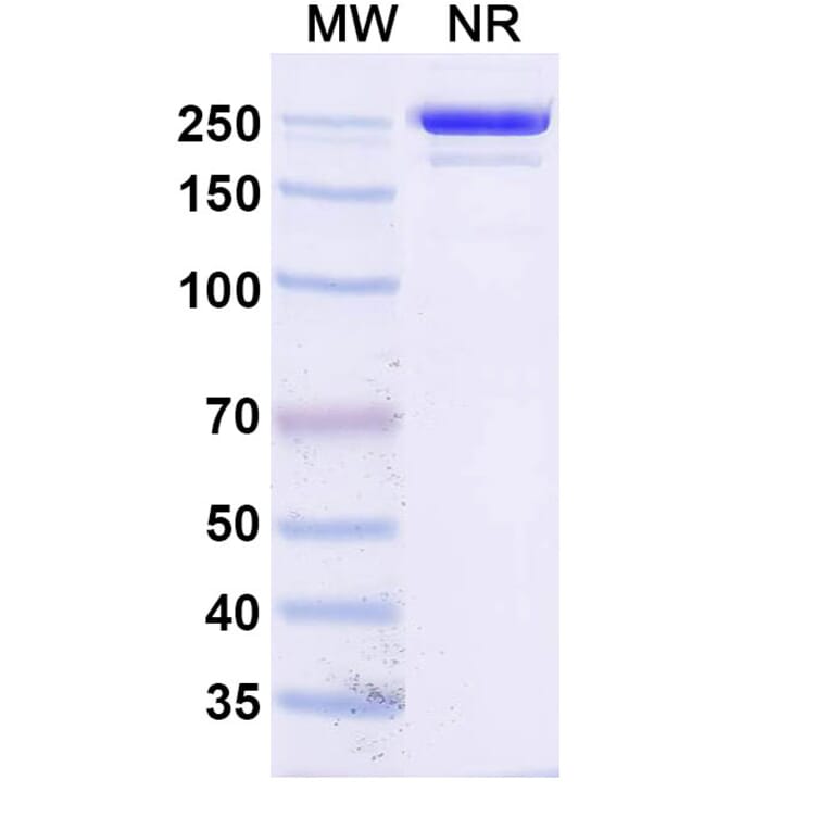 SDS-PAGE - Socazolimab Biosimilar - Anti-PD-L1 Antibody - BSA and Azide free (A339135) - Antibodies.com