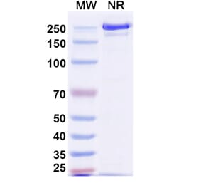 SDS-PAGE - Tagitanlimab Biosimilar - Anti-PD-L1 Antibody - BSA and Azide free (A339136) - Antibodies.com
