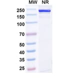 SDS-PAGE - Gumokimab Biosimilar - Anti-IL-17A Antibody - BSA and Azide free (A339151) - Antibodies.com