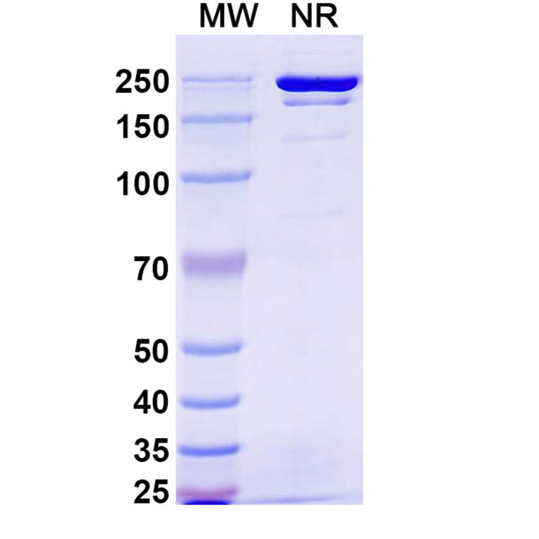 SDS-PAGE - Gumokimab Biosimilar - Anti-IL-17A Antibody - BSA and Azide free (A339151) - Antibodies.com