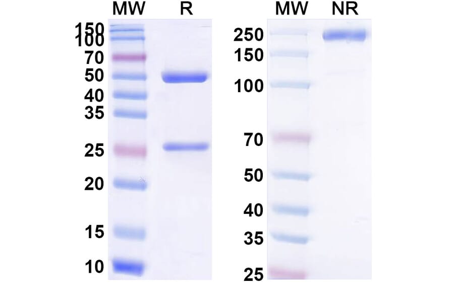 Chromatography profile - Pivekimab Biosimilar - Anti-CD123 Antibody - BSA and Azide free (A339153) - Antibodies.com