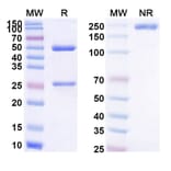 SDS-PAGE - Sotevtamab Biosimilar - Anti-Clusterin Antibody - BSA and Azide free (A339156) - Antibodies.com