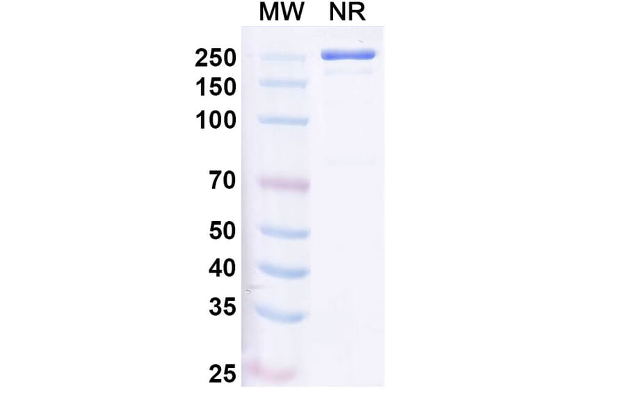 SDS-PAGE - Ulenistamab Biosimilar - Anti-ZG16B Antibody - BSA and Azide free (A339157) - Antibodies.com