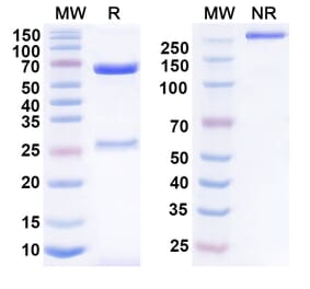 SDS-PAGE - Anumigilimab Biosimilar - Anti-G-CSFR Antibody - BSA and Azide free (A339160) - Antibodies.com