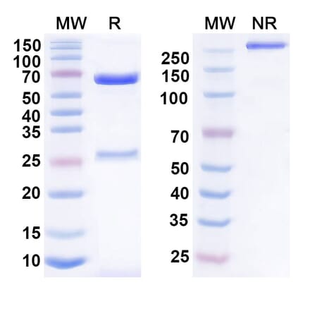 SDS-PAGE - Anumigilimab Biosimilar - Anti-G-CSFR Antibody - BSA and Azide free (A339160) - Antibodies.com