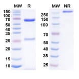 SDS-PAGE - Anumigilimab Biosimilar - Anti-G-CSFR Antibody - BSA and Azide free (A339160) - Antibodies.com