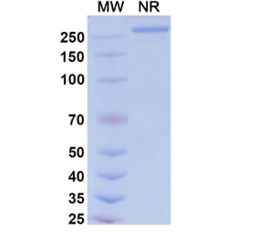 SDS-PAGE - Tarcocimab Biosimilar - Anti-VEGFA Antibody - BSA and Azide free (A339164) - Antibodies.com