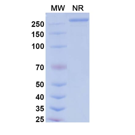 SDS-PAGE - Tarcocimab Biosimilar - Anti-VEGFA Antibody - BSA and Azide free (A339164) - Antibodies.com