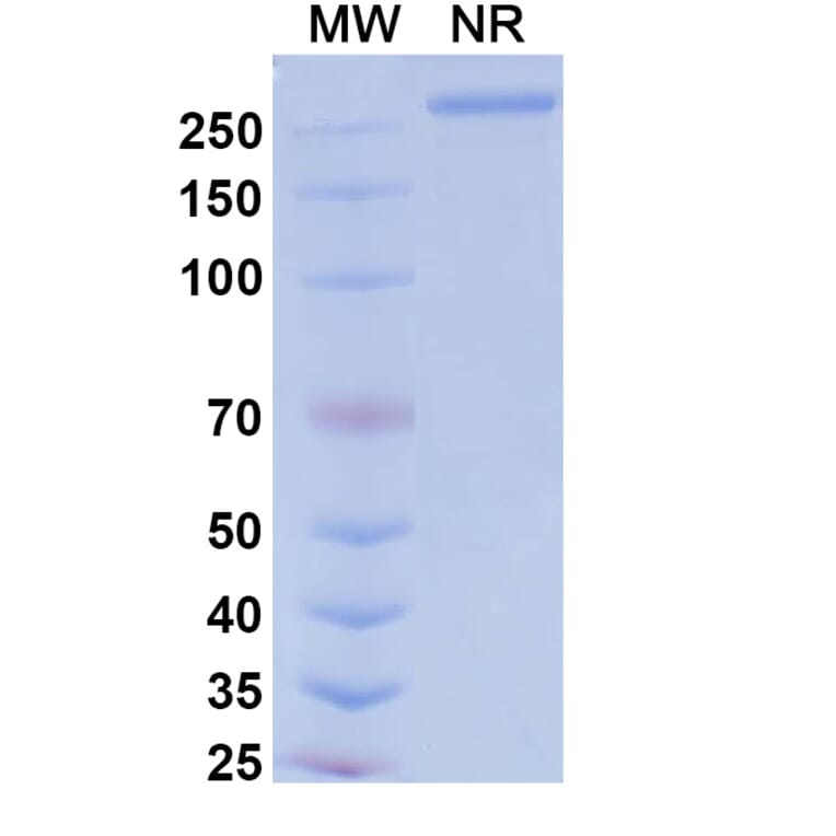 SDS-PAGE - Tarcocimab Biosimilar - Anti-VEGFA Antibody - BSA and Azide free (A339164) - Antibodies.com