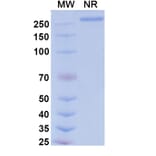 SDS-PAGE - Tarcocimab Biosimilar - Anti-VEGFA Antibody - BSA and Azide free (A339164) - Antibodies.com