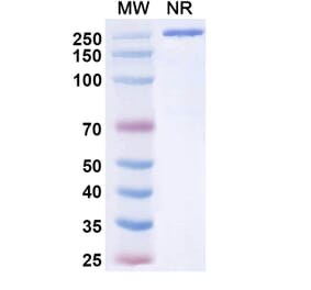SDS-PAGE - Tuvonralimab Biosimilar - Anti-CTLA-4 Antibody - BSA and Azide free (A339165) - Antibodies.com