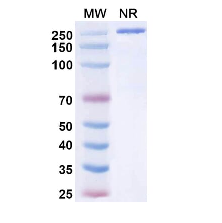 SDS-PAGE - Tuvonralimab Biosimilar - Anti-CTLA-4 Antibody - BSA and Azide free (A339165) - Antibodies.com