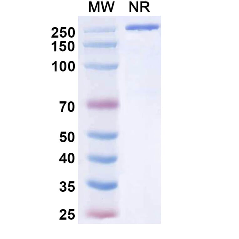 SDS-PAGE - Tuvonralimab Biosimilar - Anti-CTLA-4 Antibody - BSA and Azide free (A339165) - Antibodies.com