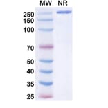 SDS-PAGE - Tuvonralimab Biosimilar - Anti-CTLA-4 Antibody - BSA and Azide free (A339165) - Antibodies.com