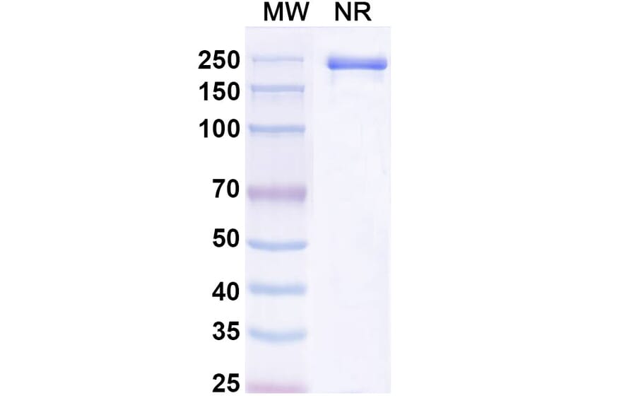 SDS-PAGE - Tuvonralimab Biosimilar - Anti-CTLA-4 Antibody - BSA and Azide free (A339165) - Antibodies.com