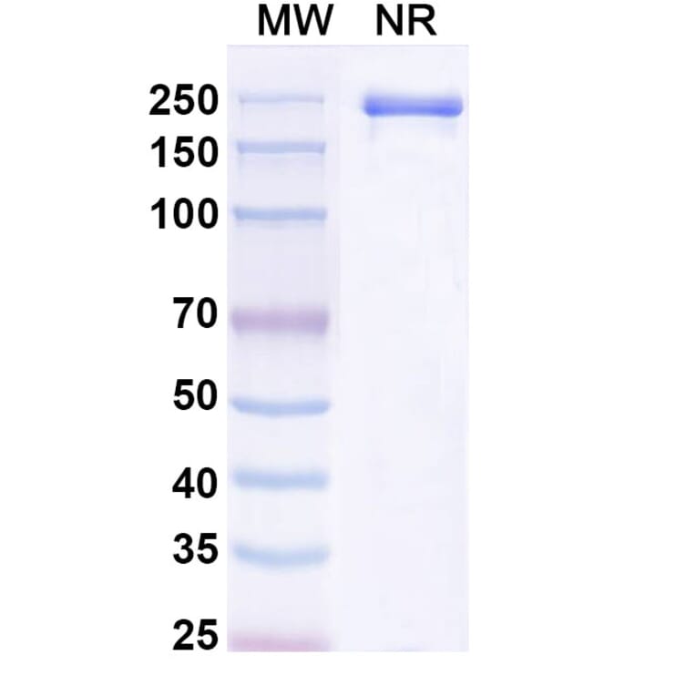 SDS-PAGE - Tuvonralimab Biosimilar - Anti-CTLA-4 Antibody - BSA and Azide free (A339165) - Antibodies.com