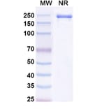 SDS-PAGE - Tuvonralimab Biosimilar - Anti-CTLA-4 Antibody - BSA and Azide free (A339165) - Antibodies.com