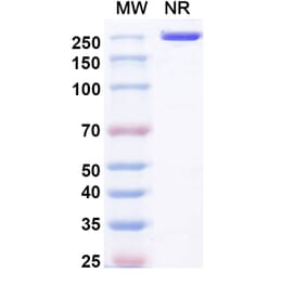 SDS-PAGE - Pulocimab Biosimilar - Anti-VEGF Receptor 2 Antibody - BSA and Azide free (A339169) - Antibodies.com