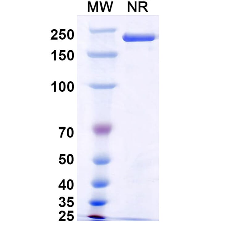 SDS-PAGE - Pulocimab Biosimilar - Anti-VEGF Receptor 2 Antibody - BSA and Azide free (A339169) - Antibodies.com