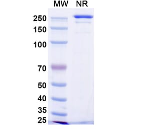 SDS-PAGE - Manfidokimab Biosimilar - Anti-IL-4R Antibody - BSA and Azide free (A339171) - Antibodies.com