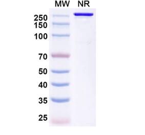 SDS-PAGE - Trinbelimab Biosimilar - Anti-RhD Antibody - BSA and Azide free (A339172) - Antibodies.com