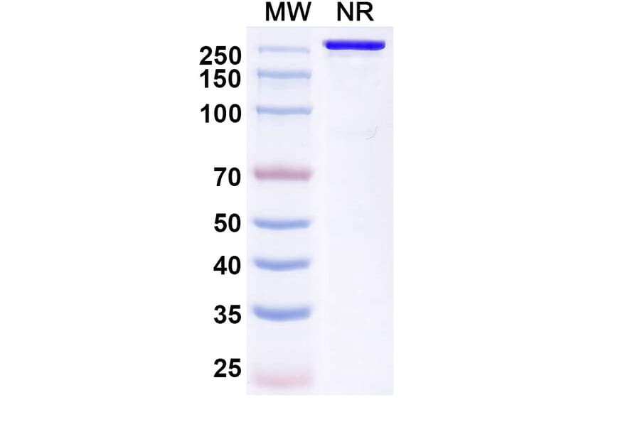 SDS-PAGE - Trinbelimab Biosimilar - Anti-RhD Antibody - BSA and Azide free (A339172) - Antibodies.com