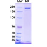 SDS-PAGE - Trinbelimab Biosimilar - Anti-RhD Antibody - BSA and Azide free (A339172) - Antibodies.com