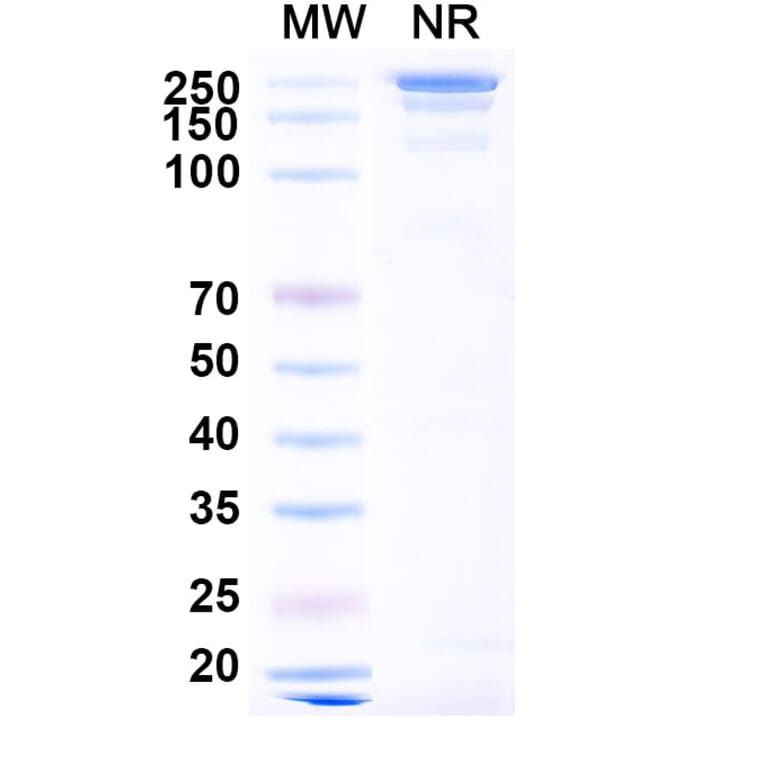 SDS-PAGE - Barzolvolimab Biosimilar - Anti-c-Kit Antibody - BSA and Azide free (A339173) - Antibodies.com