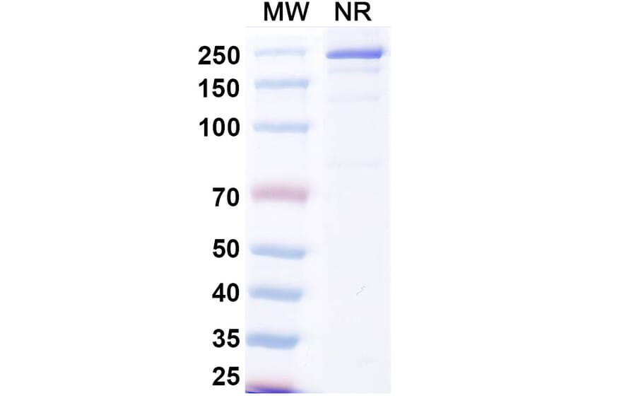 SDS-PAGE - Beludavimab Biosimilar - Anti-SARS-CoV-2 Spike Protein RBD Antibody - BSA and Azide free (A339179) - Antibodies.com
